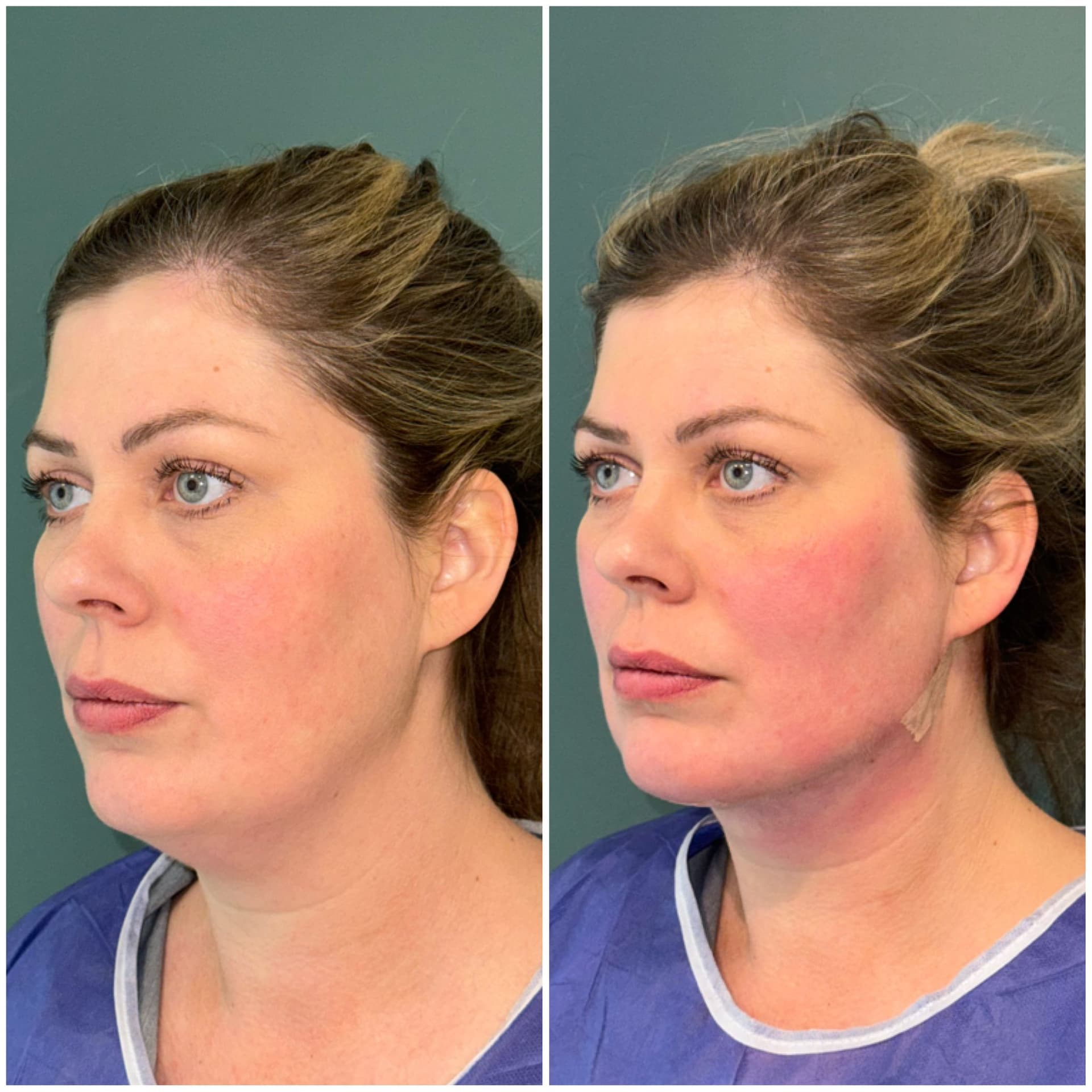 Pro Clinique Resultat 4